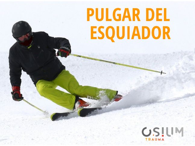pulgar del esquiador