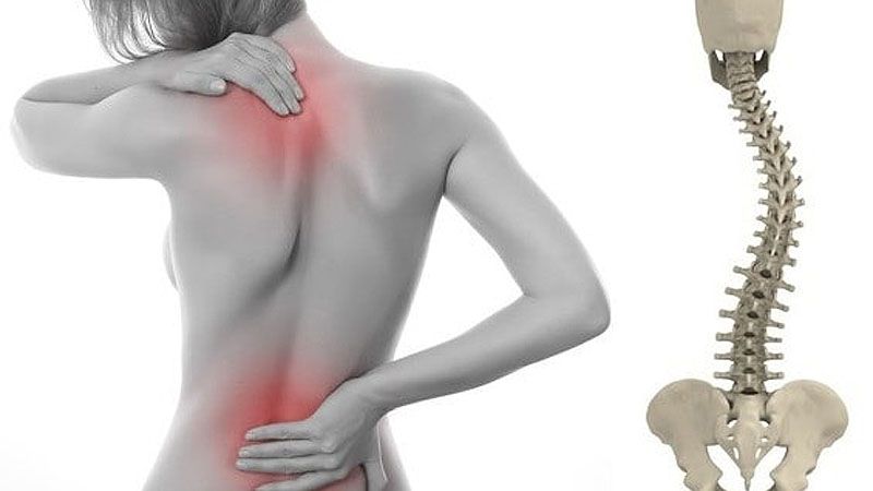 Escoliosis